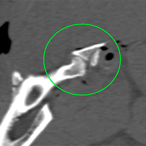 dog ct fracture temporomandibular joint