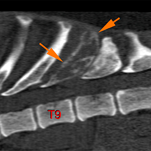 Dog CT Scan osteolytic lesion in spinous process