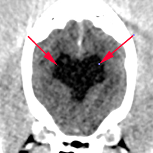 dog ct ventricles distended