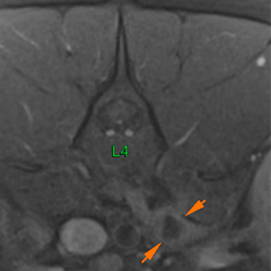 Dog MRI lesion in left psoas muscle