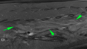 Dog MRI myositis of the left psoas muscle