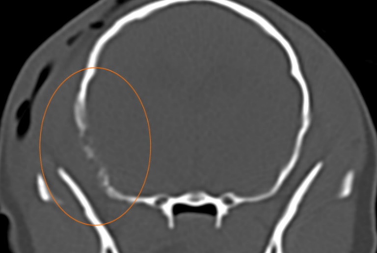 Dog CT abscess affecting temporal bone