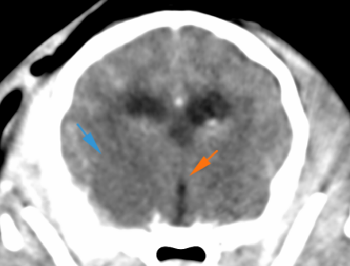 Dog Ct cerebral oedema and mass-effect