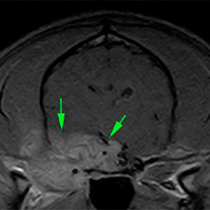 Dog MRI intracranial invasion