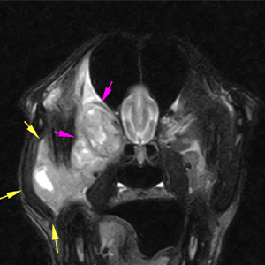 Dog MRI mass affecting masseter muscle