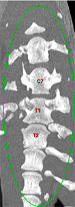 canine CT left shift longitudinal vertebral axis