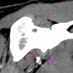 canine CT joint effusion