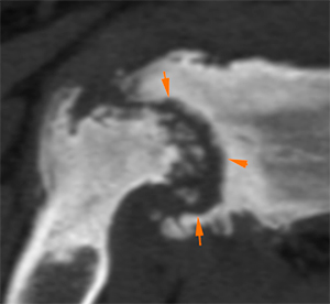 canine CT shoulder bone lysis