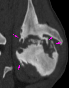 canine CT shoulder periarticular new bone formation and sclerosis