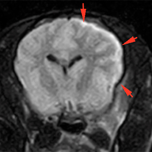 meningeal thickening, subdural empyema, dog, MRI