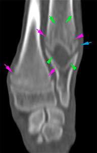 canine CT metaphyseal osteopathy/hypertrophic osteodystrophy and retained cartilaginous core distal ulnar metaphysis.