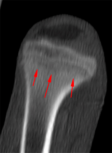 canine CT metaphyseal osteopathy/hypertrophic osteodystrophy