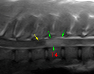 canine MRI intramedullary lesion and syringohydromyelia