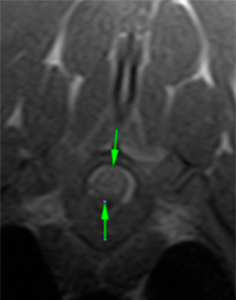 canine MRI intramedullary lesion