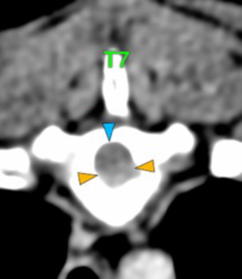 Dog, thoracolumbar spine, vertebra
