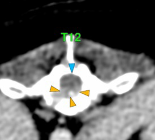 Dog, thoracolumbar spine, vertebra