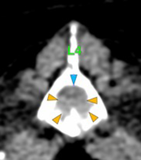 Dog, thoracolumbar spine, vertebra