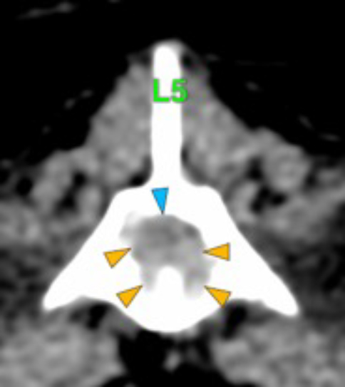 Dog, thoracolumbar spine, vertebra