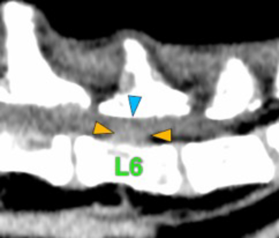 Dog, thoracolumbar spine, vertebra