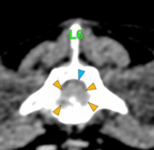 Dog, thoracolumbar spine, vertebra