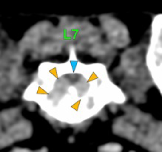 Dog, thoracolumbar spine, vertebra