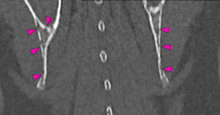 Dog, thoracolumbar spine, scapula, pelvic bones
