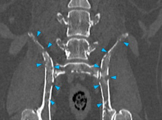 Dog, thoracolumbar spine, scapula, pelvic bones