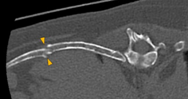 Dog, thoracolumbar spine, ribs