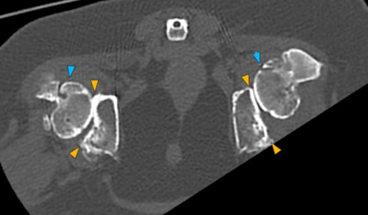 Dog, thoracolumbar spine, coxofemoral joints