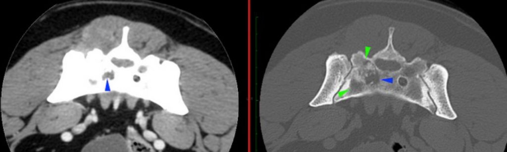 dog, CT, thoracolumbar spine, sacrum